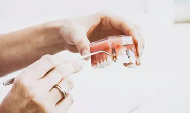Endodonzia conservativa&